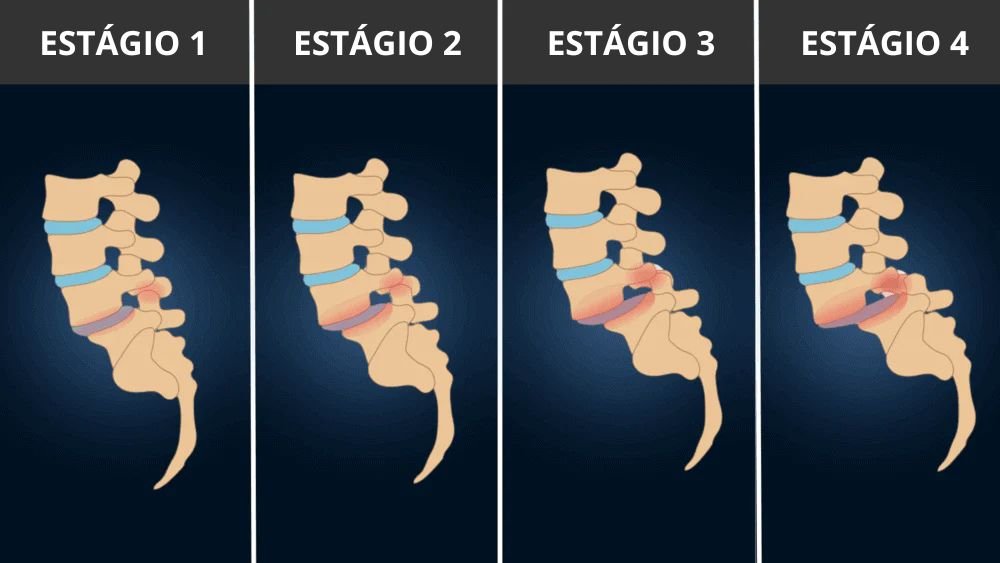 Coluna
